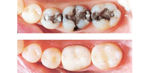 West LA Dental Care Heigiene