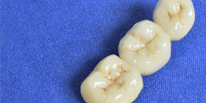 West LA Dental Care Heigiene