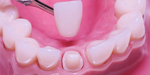 West LA Dental Care Heigiene