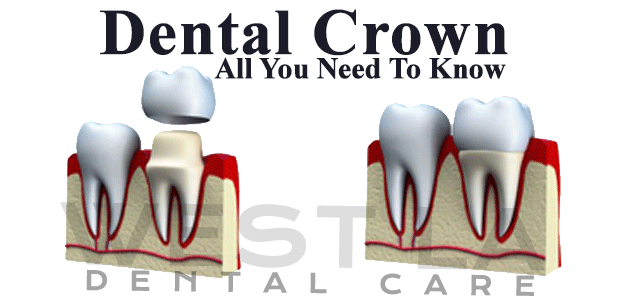 West LA Dental Care Oral Hygeine