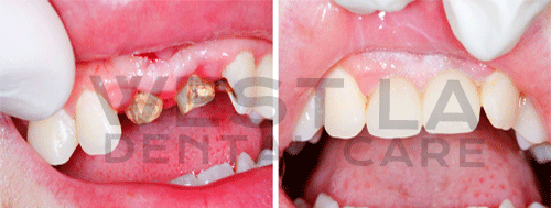 West LA Dental Care Heigiene