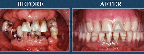 West LA Dental Care Heigiene