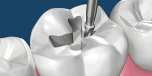 West LA Dental Care Heigiene
