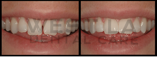 West LA Dental Care Heigiene