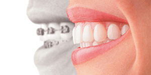 West LA Dental Care Heigiene