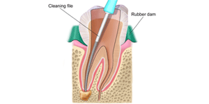 West LA Dental Care Heigiene