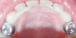 West LA Dental Care Heigiene