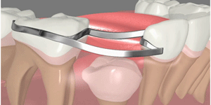 West LA Dental Care Heigiene