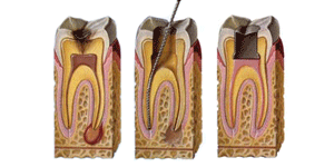 West LA Dental Care Heigiene