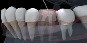 West LA Dental Care Heigiene